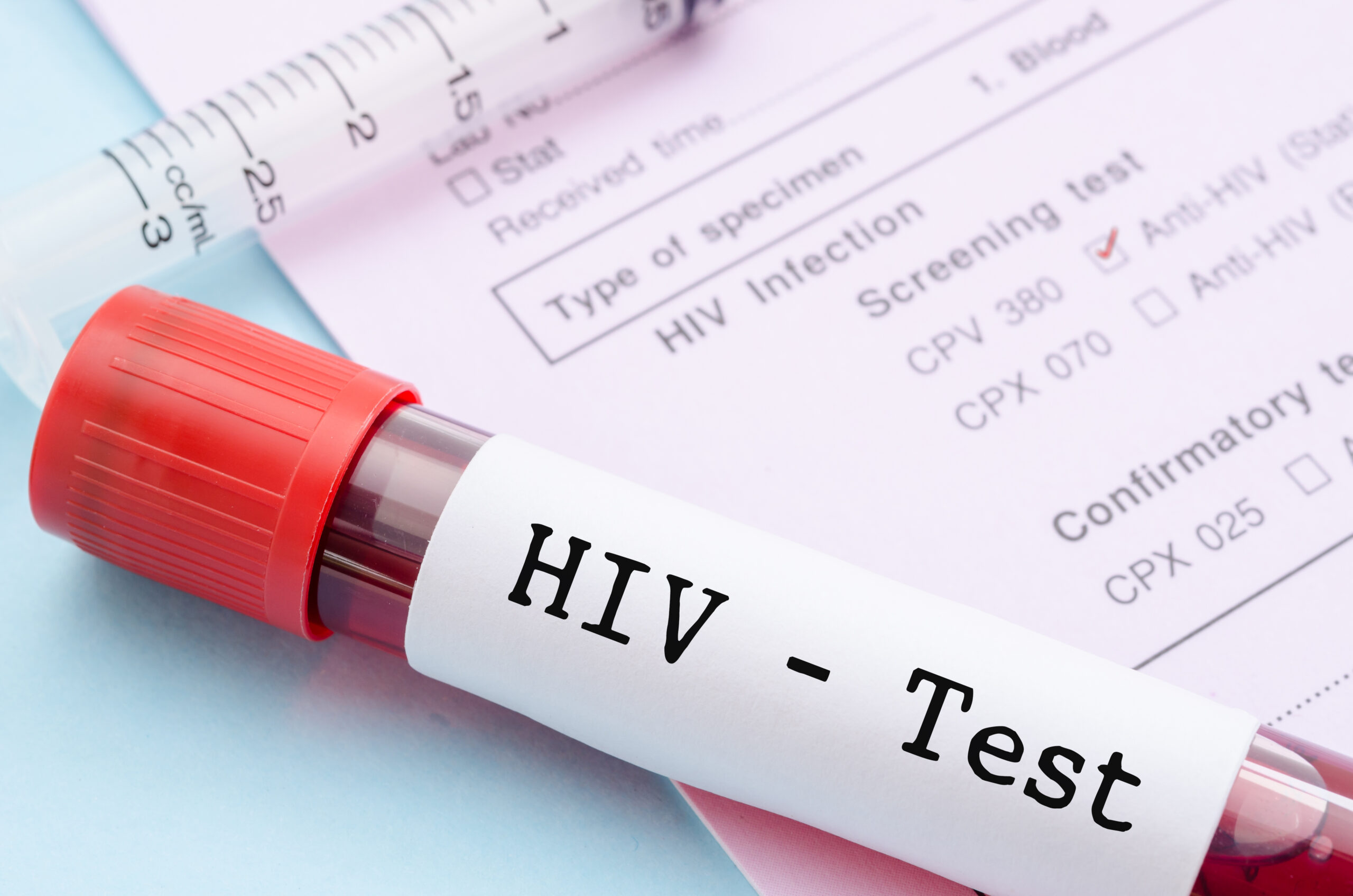 Get a Free HIV Test for National HIV Testing Day